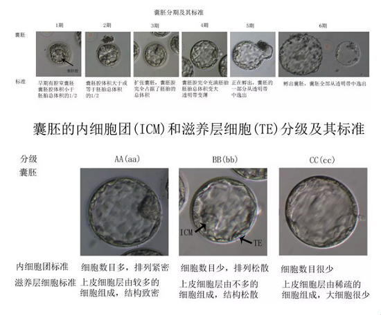 囊胚评分